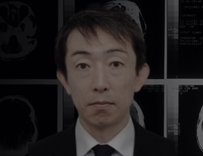 ウェビナーオンデマンド】私の頭蓋底外科習得方法と血管障害を中心と